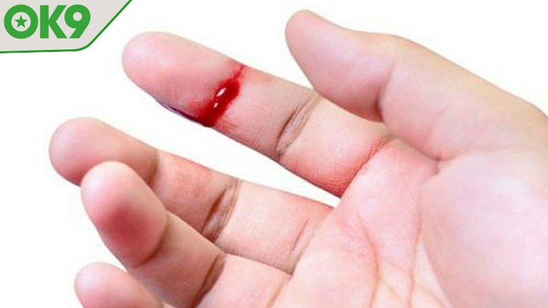 Mỗi kiểu thấy máu đi kèm với dàn số lộc lá khác nhau
